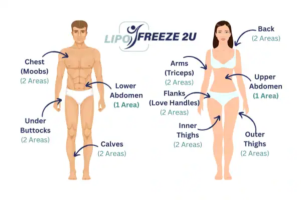 Areas you can have fat freezing treatment Burgess Hill