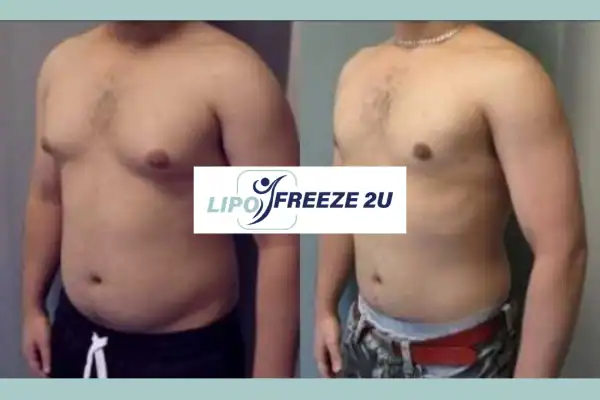 How Long Does It Take to See Results Burgess Hill?