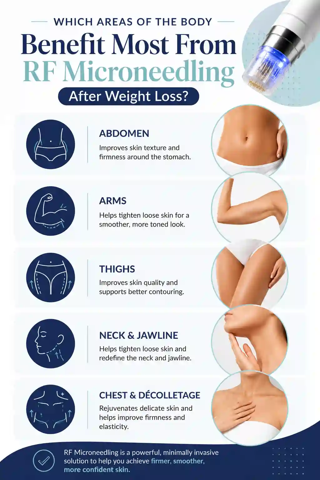 Which Areas of the Body Benefit Most From RF Microneedling After Weight Loss Burgess Hill